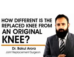 Difference between replaced knee and original knee.