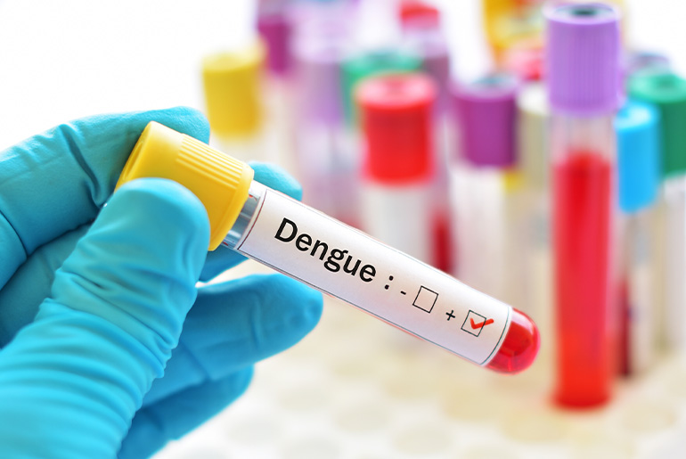 Steps to Prevent Dengue in Monsoons