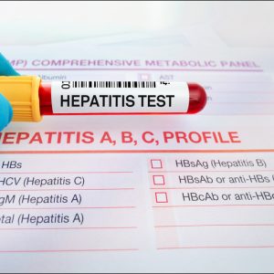 An In-Depth Comparison Between Hepatitis A vs Hepatitis B