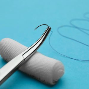 How to Care for and Manage Absorbable Stitches